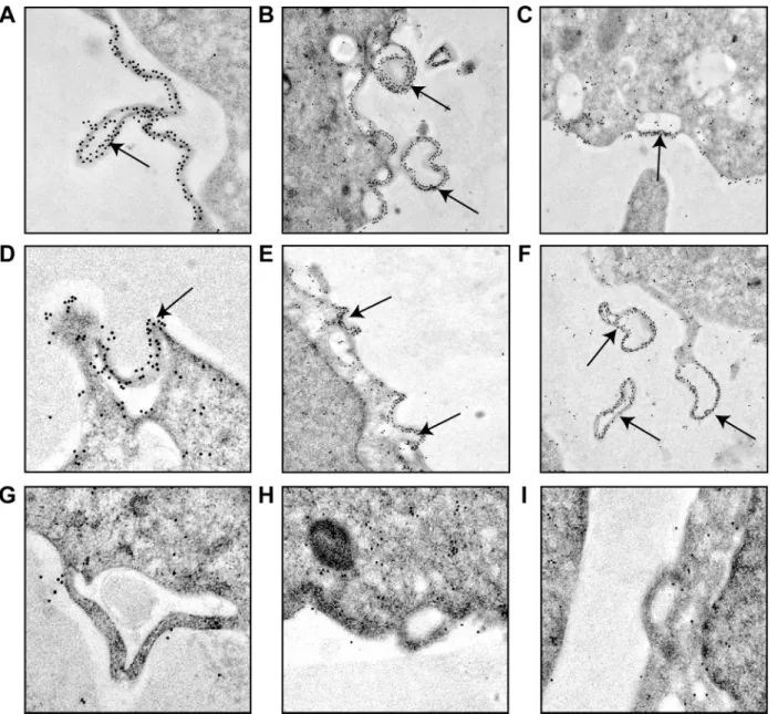 Fig 4. Induction of vesicle budding from the plasma membrane by VSV M proteins. BHK-T7 cells were transfected for 2 h with pTM1 encoding M1 (A-F), pTM1 empty (G), M2 (H) or M3 (I)