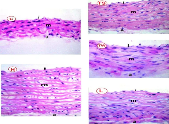 Figure  2.    Effect  of  ingestion  of  TS,  TW  and  L  on  the  morphologic  changes  of  the  rat  aorta  stained by hematoxylin and eosin using a light microscope (magnification 160 ⨉ )