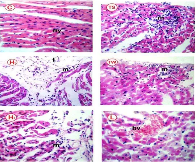 Fig.  1.  The  effect  of  ingestion  of  TS,  TW  and  L  on  the  morphologic  changes  of  the  rat  heart  stained with hematoxylin and eosin using a light microscope (magnification 80 ⨉ )
