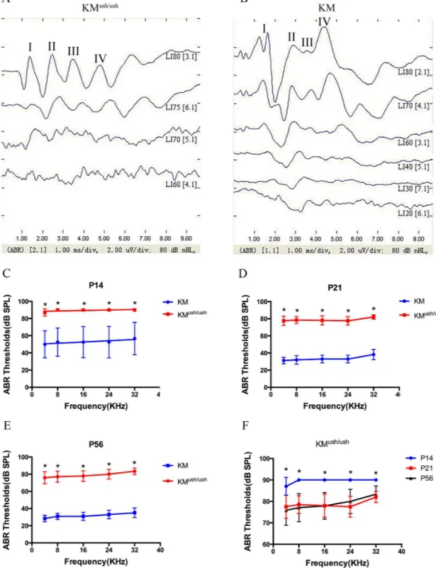 Fig 2. ABR tests for KM ush/ush and age-matched controls. (A-B), Responses to click stimuli showed that the waveforms of ABR usually consist of 4 or 5 response peaks, labeled I, II, II, and IV respectively