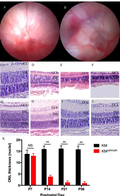 Fig 3. Morphology changes of fundus and retinas of KM ush/ush and control mice. (A-B), Fundus photography performed at P21