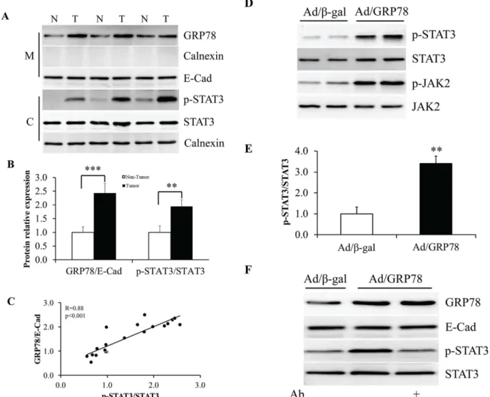 Fig 4. Stimulation of STAT3 phosphorylation by sGRP78. (A) Western blotting of sGRP78 protein and STAT3 phosphorylation in human breast tumor and non-tumor tissues