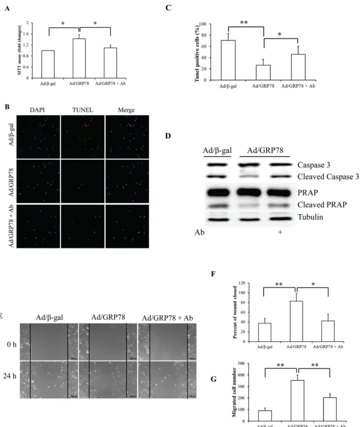 Fig 3. Effect of sGRP78 on cell proliferation, apoptosis, and migration. (A) Effect of sGRP78 on cell proliferation