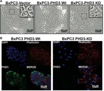 Figure 2. PHD3 knockdown affects cell-cell adhesion and actin cytoskeletal morphology