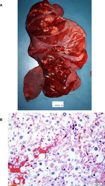 Figure 2. Postmortem examination of the lungs reveals multiple cryptococcal lesions. a
