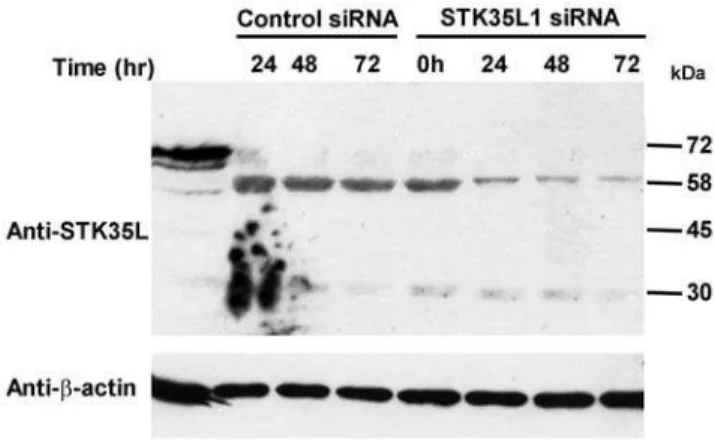 Figure 5. Knockdown of STK35L1 protein expression. To knockdown the STK35L1 protein expression, EC were transfected with pooled STK35L1 siRNA or control siRNA