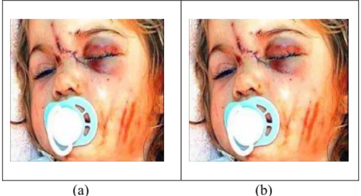 Figure 6: (a) Original Image (b) Stego Image  Figure 7 shows another example of image with data hidden  inside the image