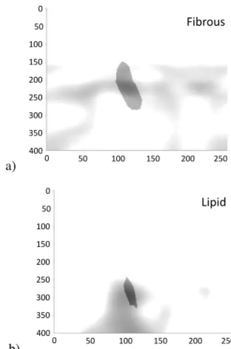 Fig. 8.  Soft-Decision Results from the tissue characterization of the Fibrous (a)  and Lipid (b) ROI by using the Histogram-based Model (NH)