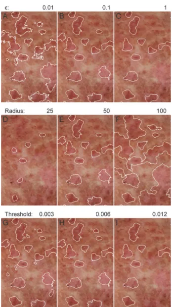 Figure 2. Impact of different parameters on automatically identified actinic keratosis lesions