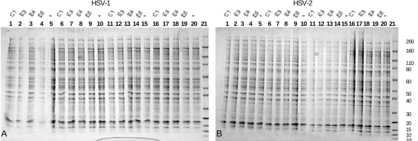 Fig. 22 Imagem obtida por análise eletroforética em MidiGel desnaturante NuPageNovex 4-12%/ Bis-Tris, utilizando como electrólito tampão MOPS