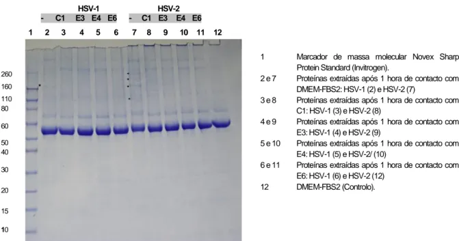 Fig.  23  Imagem  obtida  por  análise  eletroforética  em  MidiGel  desnaturante  NuPageNovex  4-12%/Bis-Tris  utilizando  como  electrólito  tampão  MOPS