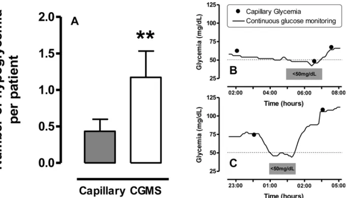 Figure 2. Number of hypoglycemic episodes per patient in the IGM-group and examples of hypoglycemic episodes