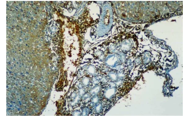 Figure 3. After hepatotoxin-induced cirrhosis was formed, staining for laminin was especially pronounced in the fibrotic areas around the central veins, in the hepatic sinusoids and on the basement membranes of proliferating bile ducts or ductules