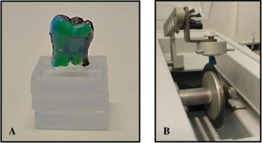 Fig 3 – (A) Coroa colada em base de acrílico; (B) Secção das restaurações com máquina de corte.