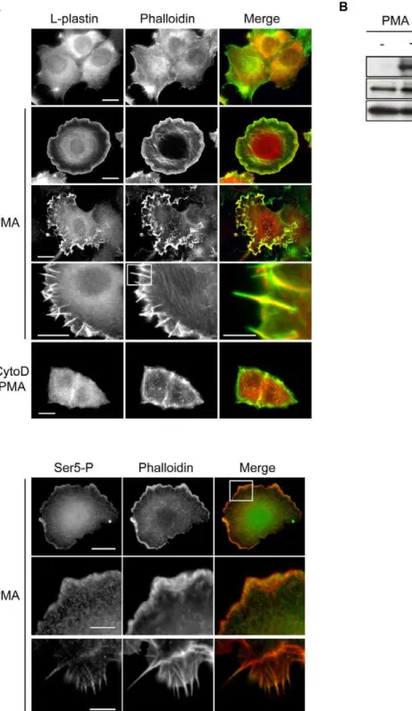 Figure 3. PMA induces the translocation of L-plastin to de novo assembled actin structures and triggers L-plastin phosphorylation