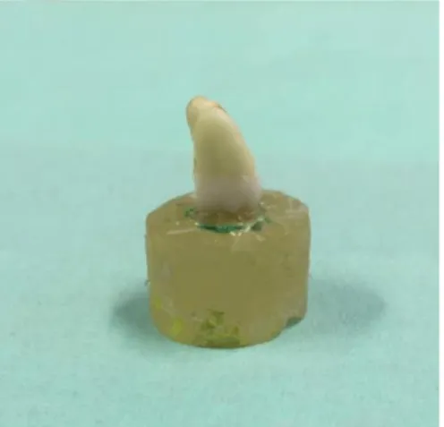 Figura 1- Dente montado num suporte  de acrílico com cera colante 