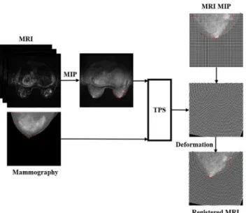 Fig 1. The proposed framework for MRI to mammography registration.