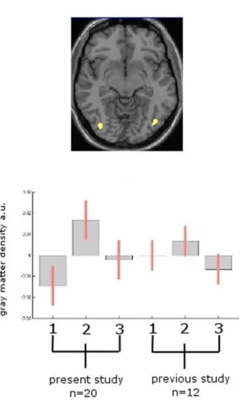 Figure 3 bottom: Box plot of the parameter estimates for both samples in the MT-area (right hMT/V5) using the contrasts described in the text to test for medium effects in both groups (no conjunction)