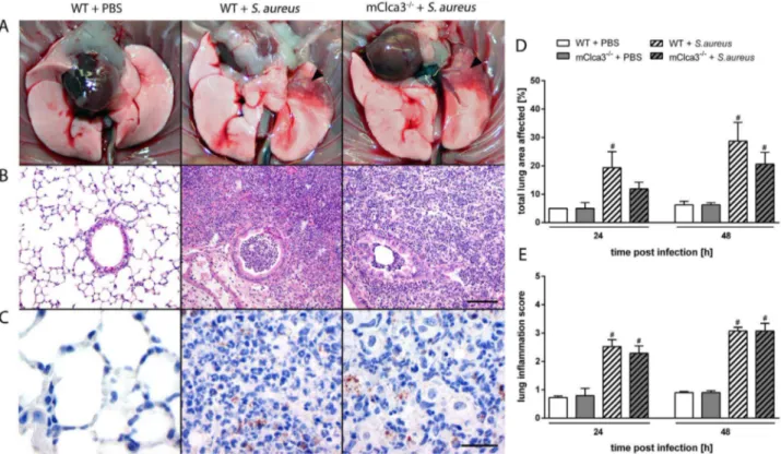 Figure 9. mCLCA3 had no impact on severity or expansion of lung inflammation. (A) 24 hours after infection, left lungs of Staphylococcus aureus infected mice were used for quantification of lung lesions by Cavalieri principle