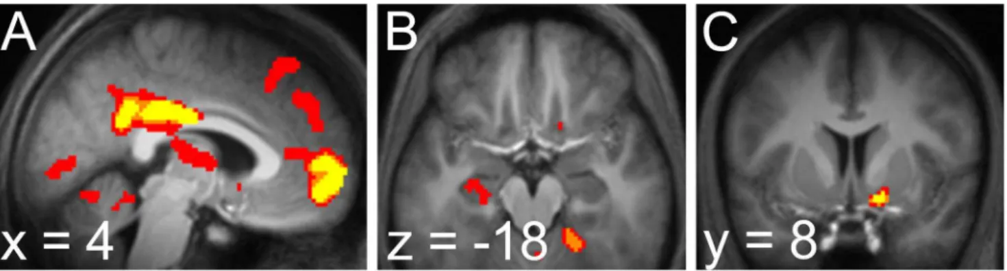 Figure 6 illustrates activity in nucleus accumbens correlated with the RPE regressor computed from the slow learning rate (peak 10, 12, 22 ; p v 0 : 001 after correction for family-wise error due to multiple comparisons over an anatomical mask of the nucle