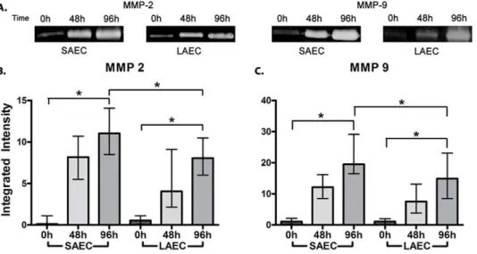 Figure 3. The role TGFb receptor II (TGFBRII) and of Smad3 activation as potential mechanisms underlying the differential susceptibility of small airway epithelial cells (SAEC) and large airway epithelial cells (LAEC) to TGFb1 induced EMT