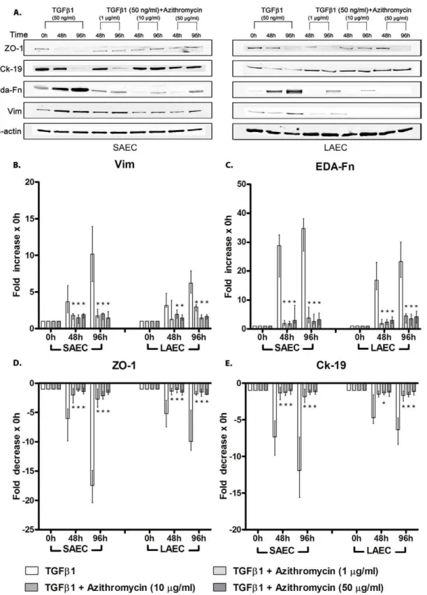 Figure 4. Effect of Azithromycin on TGFb1-induced EMT of primary human small and large airway epithelial cell cultures – expression of epithelial and mesenchymal markers