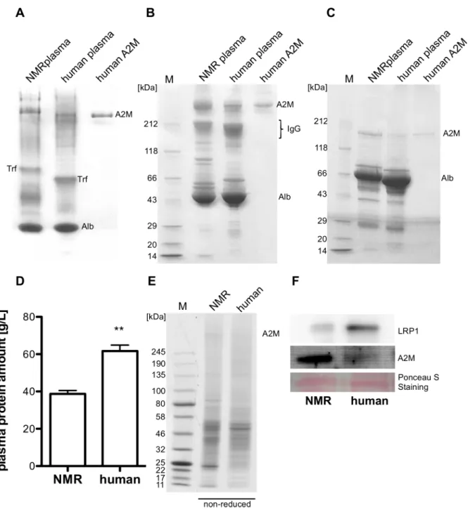 Fig 2. Plasma and liver protein analysis. NMR, human plasma (30μg) and purified human A2M (2.5μg) were separated by native PAGE (4–20%) (A) and SDS-PAGE (4–20%) under non-reducing (B) and reducing conditions (C)