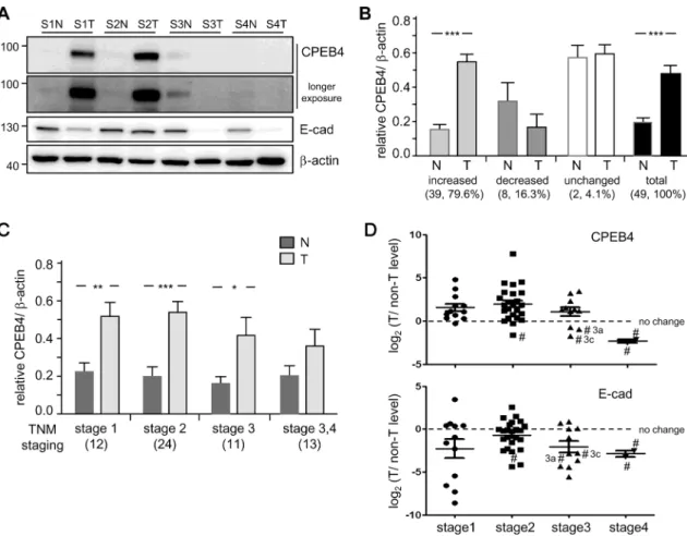 Fig 5. Increased CPEB4 protein level in most HCC specimens. Western blot analysis of CPEB4 MoAb (homemade#2) described in Fig 4A in tumorous (T) and adjacent non-tumorous (N) liver samples from 49 HCC patients at different stages (S1-S4)