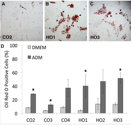 Figure 3. GO cells differentiate into adipocytes in monolayer cultures. (A–C) Representative images of orbital fibroblasts (A, Control-CO2; B, GO-HO1; C, GO- HO3) stained with Oil Red O after 2 weeks culture in adipocyte differentiation medium