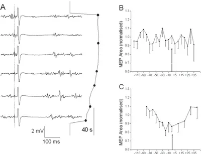 Fig. 2 – Distribution of patterns of changes in motor evoked potential (MEP) magnitude and silent period (SP) duration in electromyography (EMG) of the adductor pollicis muscle (A) and musculus brachioradialis (B) during sustained 60%