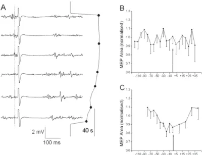 Fig. 2 – Distribution of patterns of changes in motor evoked potential (MEP) magnitude and silent period (SP) duration in electromyography (EMG) of the adductor pollicis muscle (A) and musculus brachioradialis (B) during sustained 60%