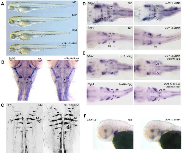 Figure 6. Overexpression of miR-10 induces HoxB1a and HoxB3a loss of function phenotypes