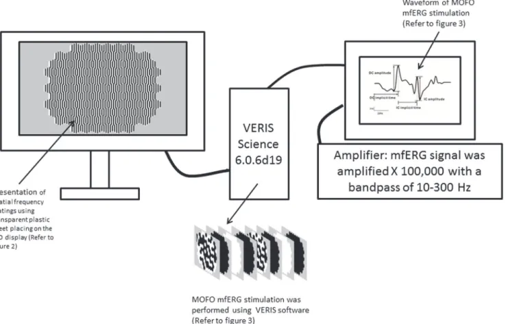 Fig 1. The schematic diagram of mfERG setup for experiment 1 and 2. The spatial frequency (SFs) gratings were presented on a 22-inch LCD display.
