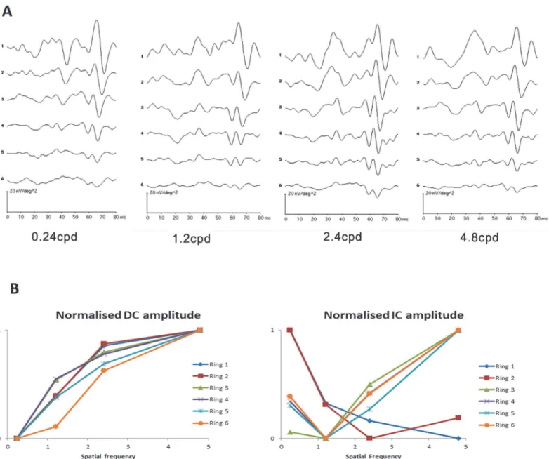 Fig 4. The global flash mfERG response to spatial frequency. (A) The typical global flash mfERG waveform measured from one subject with 4 spatial frequencies grating for six different retinal regions