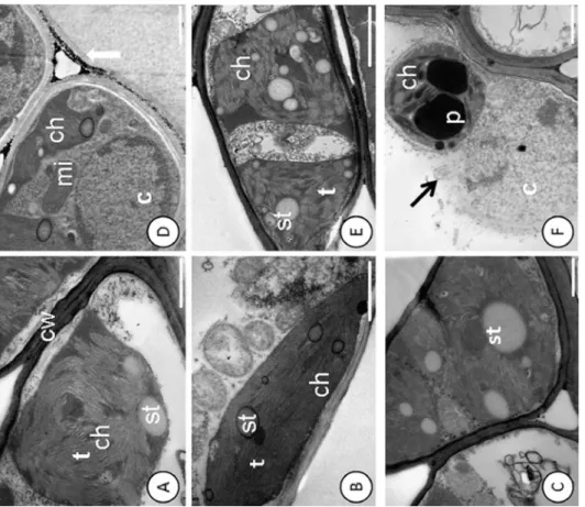 Fig 1. Disruption of the nuclear membrane and deposition of electro-dense material in the cell wall detected by ultrastructural micrographs of leaf mesophyll cells