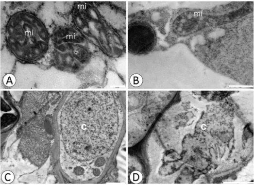 Fig 4. Changes in the nucleus and mitochondria detected by ultrastructural micrographs of root tissue cells