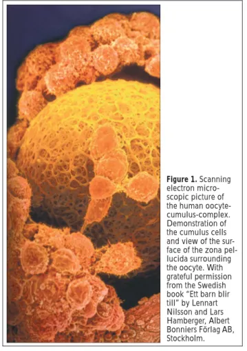Figure 1. Scanning electron  micro-scopic picture of the human  oocyte-cumulus-complex.