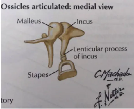 Figura 10 -  Cadeia ossicular do ouvido  médio(martelo, bigorna e estribo) 11