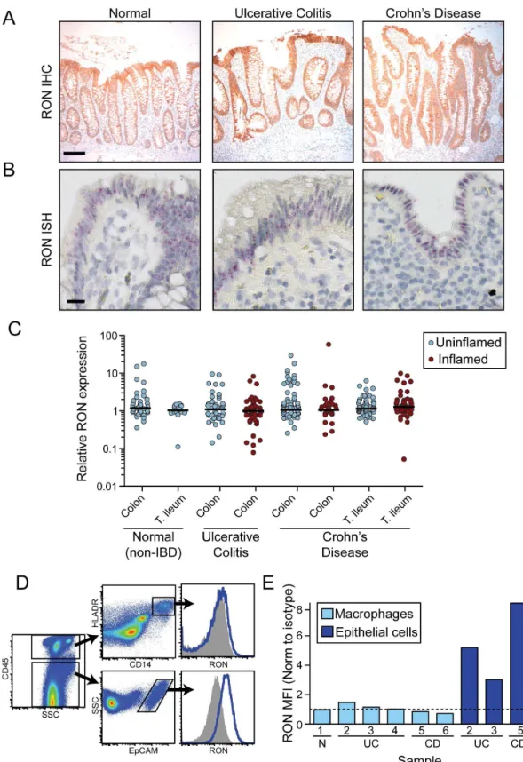 Figure 3. RON is preferentially expressed by epithelial cells in human tissues under steady-state and disease conditions