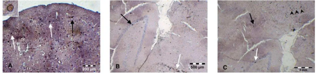 Figure 1. Immunohistochemical staining for tracing of BrdU-labeled cells; (A) the brown stain of the nuclei of BrdU+ cells are indicated  by black and white arrows in cortex (scale bar 200  μ m), a BrdU+ nucleus is shown by a higher magnification at the le