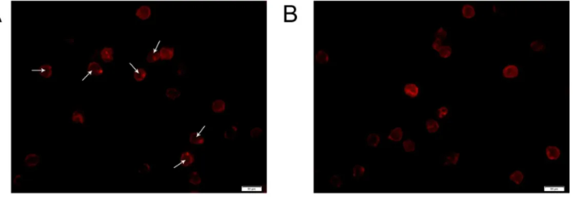 Figure 6. A hypothesis of the increased migration of CD4 + T cells by the down-regulation of miR-142-3p in ASO