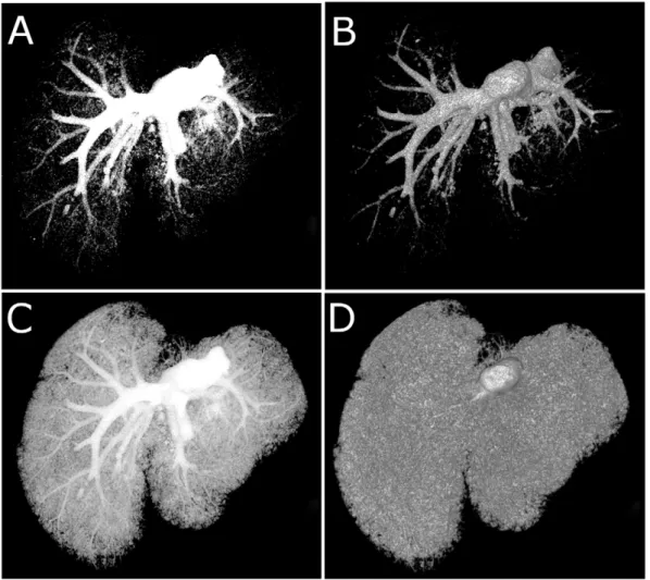 Figure 2. Combined analysis of threshold manipulated MIP and volume rendered data yields greater understanding of vascular networks