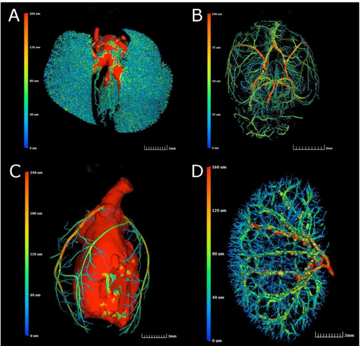 Figure 4. Vessel morphometrics can be derived from perfused mouse organ vasculature. Color bar on left of each panel indicates associated vessel diameters