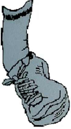 Figura 3: Entorse do tornozelo por inversão (adaptado de Massada, 2003). 