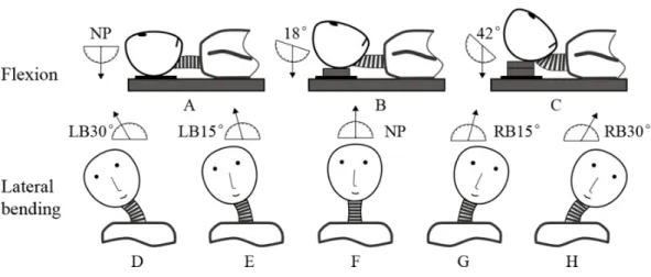 Figure 1 Three postures in flexion: (A) neutral position (NP), (B) first flexion at 18 ◦ , and (C) second flexion at 42 ◦ 
