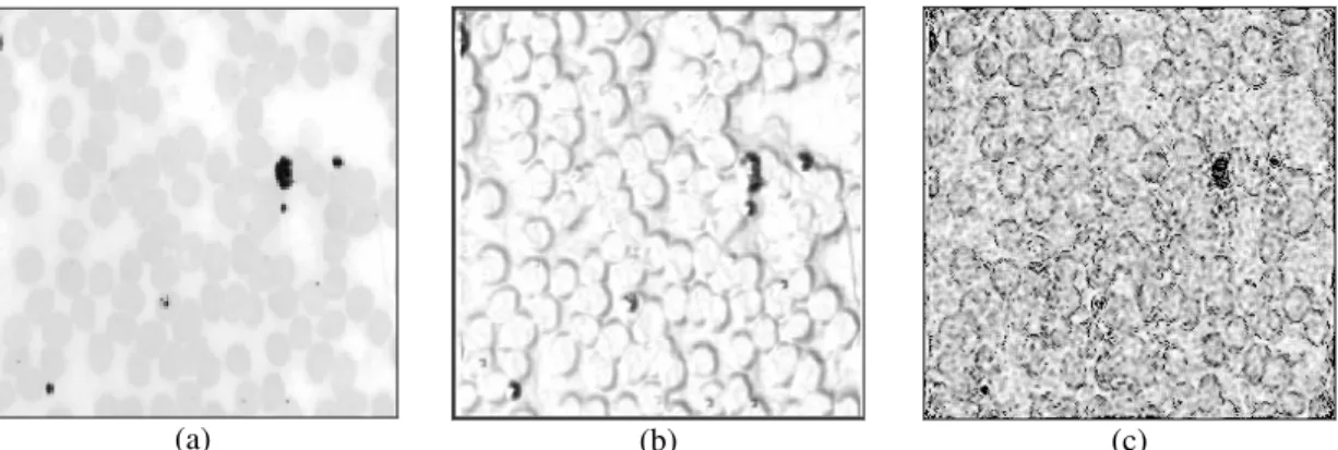 Fig 4. Comparison of outputs for cell.tif image.  (a) Original Image. (b) Edge-detected image using edge similarity  measure