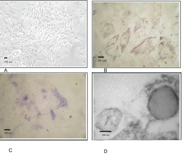 Fig. 1. Characteristics of MSCs. A. Umbilical cord derived MSCS. B. Adipogenic differentiation of MSCs was examined by Oil Red O staining