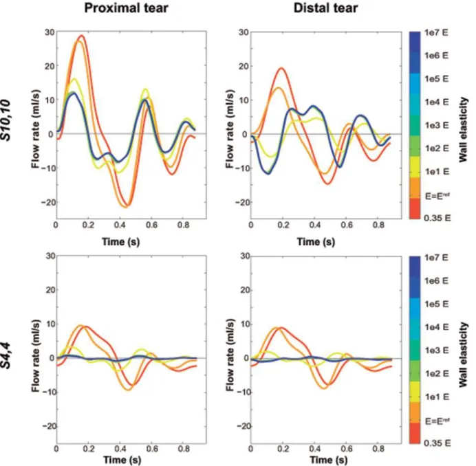 Fig 7. Changes in flow waveforms across the tears with changes in Young’s modulus. Variations in predicted flow waveforms across the proximal and distal tears with changes in Young ’ s modulus, for scenarios S 4 , 4 and S 10 , 10 