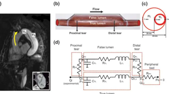 Fig 1. Proposed experimental representation of a clinical aortic dissection and its equivalent lumped-parameter model