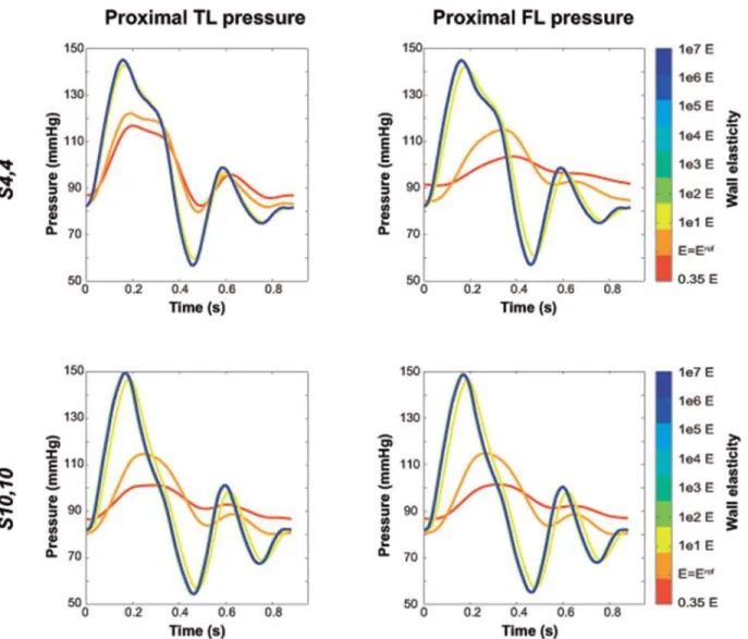 Fig 3. Changes in intraluminal pressures with changes in Young ’ s modulus. Variations in predicted intraluminal true (TL) and false lumen (FL) pressures, close to the proximal tear, with changes in Young ’ s modulus, for scenarios S 4,4 and S 10,10 